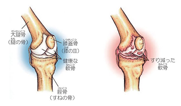 膝関節1